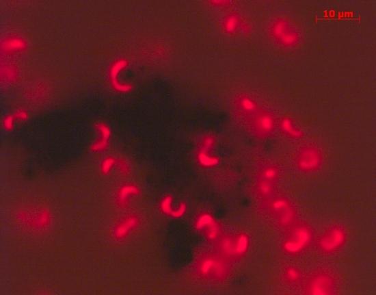 a592-2011-11-03-b1x Nanoroehrchen.jpg